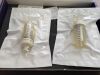 MEDTRONIC CC02A Kyphon Cement Delivery System Cement Cartridges, 8cc (Does Not Include T Connector) (X)