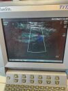 SONOSITE TITAN Titan REDUCED PRICE !!!Sonosite Titan  with probe micro convex C11