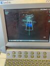 SONOSITE TITAN Titan REDUCED PRICE !!!Sonosite Titan  with probe micro convex C11