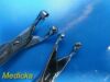 COOPER SURGICAL Euromed Sklar Weck Assored Gynaecological Instruments