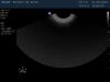 PHILIPS C8-4v Ultrasound Transducer