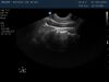 PHILIPS C8-4v Ultrasound Transducer