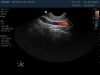 PHILIPS C8-4v Ultrasound Transducer
