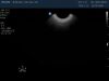 PHILIPS C9-5ec Ultrasound Transducer