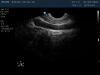 PHILIPS C9-5ec Ultrasound Transducer