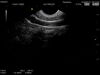 HITACHI VV531 Ultrasound Transducer