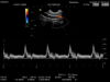 HITACHI VV531 Ultrasound Transducer
