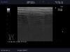 ALOKA UST-5534T Ultrasound Transducer