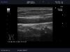ALOKA UST-5534T Ultrasound Transducer