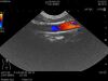 HITACHI C41 Ultrasound Transducer
