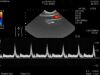 HITACHI C41 Ultrasound Transducer
