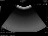 HITACHI C251 Ultrasound Transducer