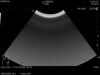 HITACHI C251 Ultrasound Transducer