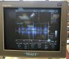 GE Vivid 3 Ultrasound with 3 Transducer Probe Linear Phase Endo on a Cart