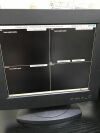 PHILIPS M3167-60007 central station ICU/CCU