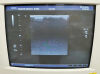 TOSHIBA PLT704AT Ultrasound Transducer