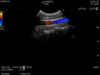 HITACHI C22I Ultrasound Transducer