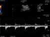 HITACHI C22I Ultrasound Transducer