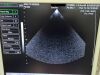 MEDISON P2-5AC Ultrasound Transducer