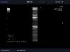 ALOKA UST-534 Ultrasound Transducer