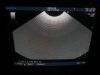 ALOKA UST-670P Ultrasound Transducer