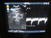 ALOKA UST-670P Ultrasound Transducer