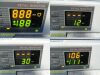 GE/COROMETRICS 155 Series, W/ ToCO & Ultrasound Transducers ~ Fetal Monitor