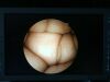 PENTAX FG-27X Gastroscope