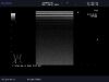 ALOKA UST-5542 Ultrasound Transducer