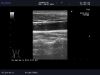 ALOKA UST-5542 Ultrasound Transducer