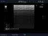 ALOKA UST-5418 Ultrasound Transducer