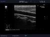 ALOKA UST-5418 Ultrasound Transducer