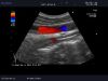 ALOKA UST-9104 Ultrasound Transducer