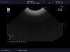ALOKA UST-9136U Ultrasound Transducer