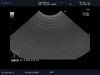 ALOKA UST-9136U Ultrasound Transducer