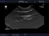ALOKA UST-9136U Ultrasound Transducer
