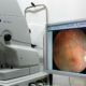 ZEISS Visucam NM/FA Fundus Camera