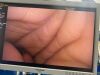 OLYMPUS ENF-VH Olympus ENF-VH Flexible Video Rhinolaryngoscope
