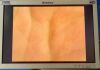 KARL STORZ SCB Image 1 Hub 222010 20 Laparoscopy System Endoscope