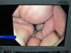OLYMPUS GIF-H190 Gastroscope