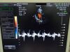 MEDISON P2-5AC Ultrasound Transducer