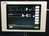 SPACELABS 90369 VITALS MONITOR