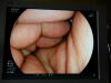 FUJINON EPX-4450 HD FICE Endoscopy Processor