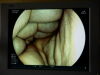 FUJINON EPX-4450 HD FICE Endoscopy Processor