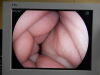 FUJINON EG-590WR Gastroscope