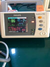 PHILIPS MP2   MP2 patient monitor module repair Monitor