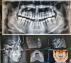 VATECH PaX-i3D Smart Dental X-Ray