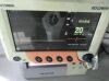 GOLDWAY 3000A  Fetal Monitoring Mainboard Fetal Monitoring Board High Voltage Board Fetal Monitor
