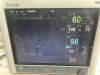 MINDRAY MEC-2000 Monitor
