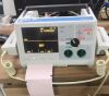 ZOLL M series defibrillator ECG unit